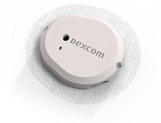 dexcom sensor