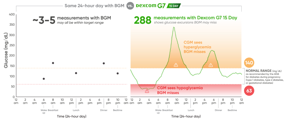 Same 24-hour day with BGM vs. Dexcom G7 15 Day