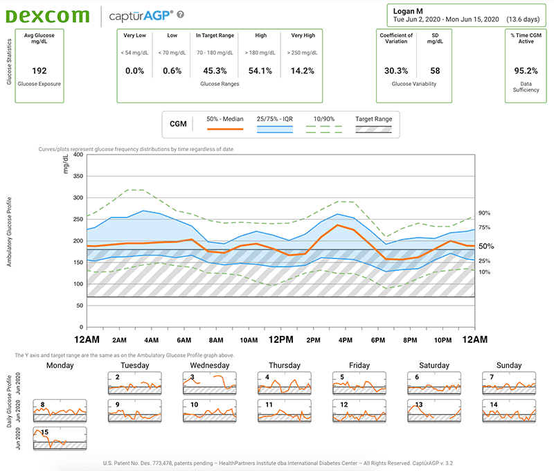 dexcom g6 reports