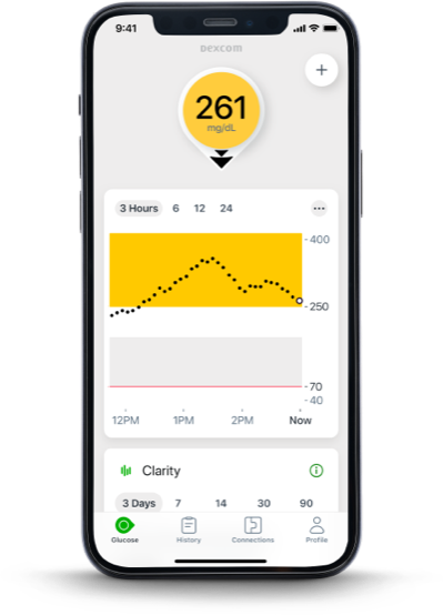 Dexcom G7 Mobile Application for Glucose Management