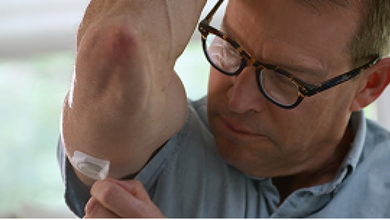man applying overpatch